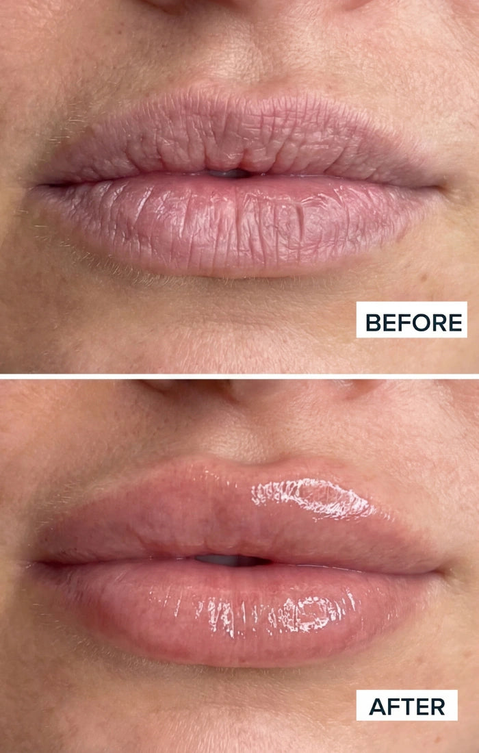 Before and after result