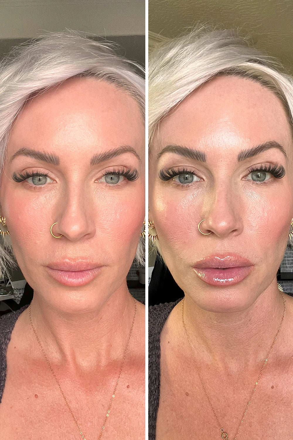 Helps Restore A Younger-Looking Lip Appearance