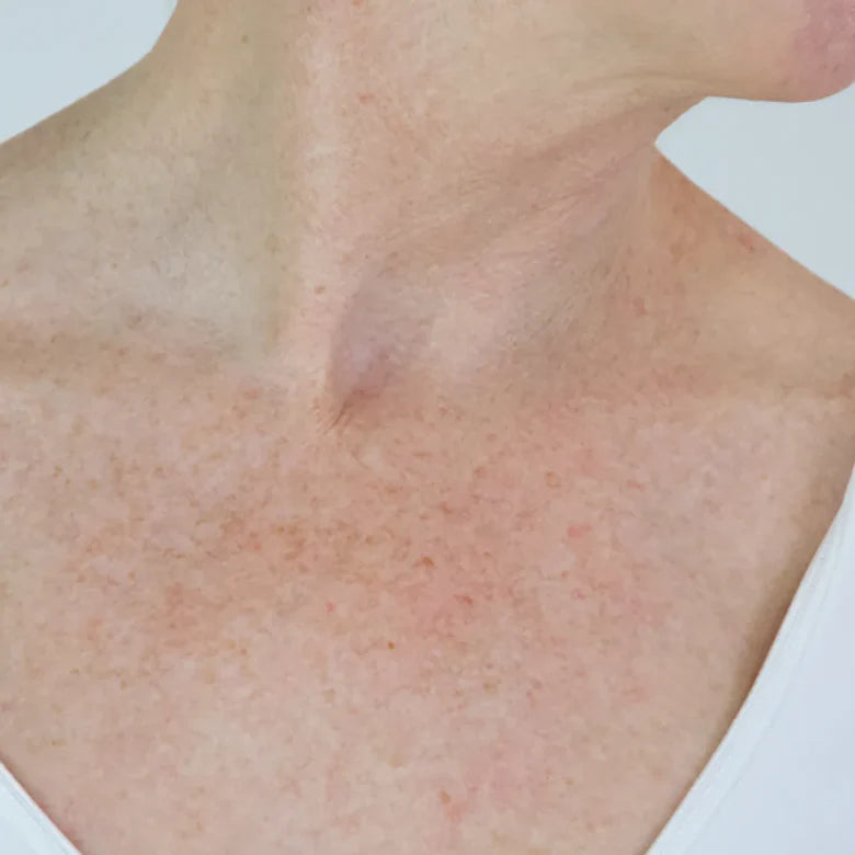 After application treatment result