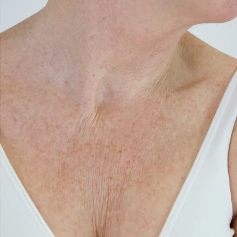 Before application treatment result