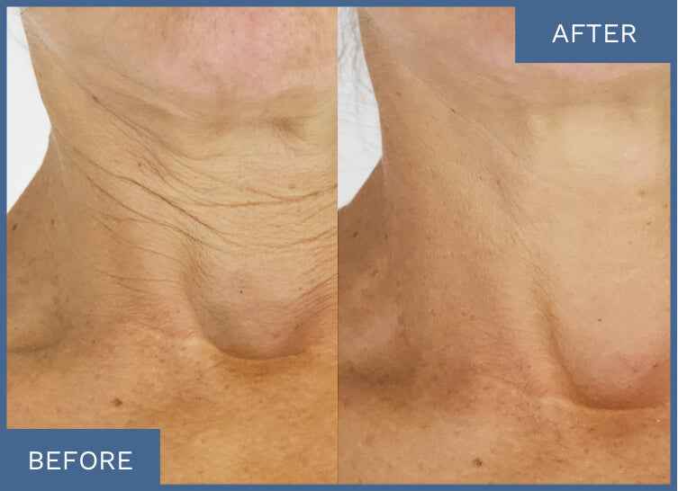 <strong>See Visible Results</strong>