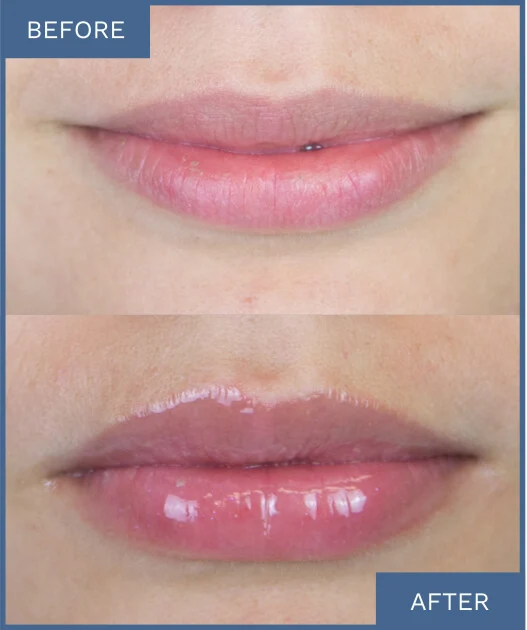 See Visible Results