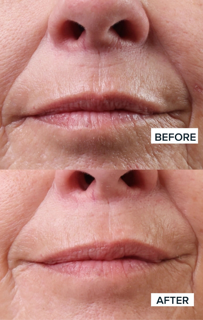 Before and after result