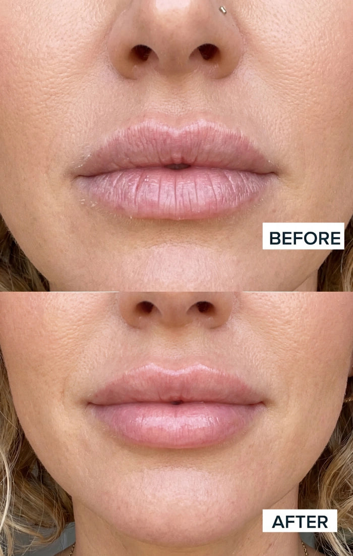 Before and after result