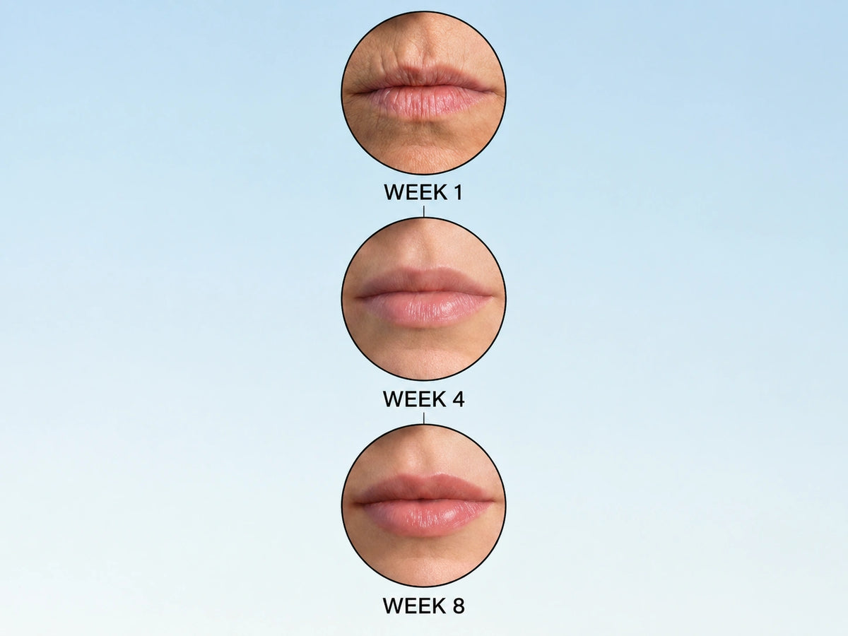 <i>Lost Your Natural Lip Contour? Here's Why 50,000+ Women Switched To THIS</i>