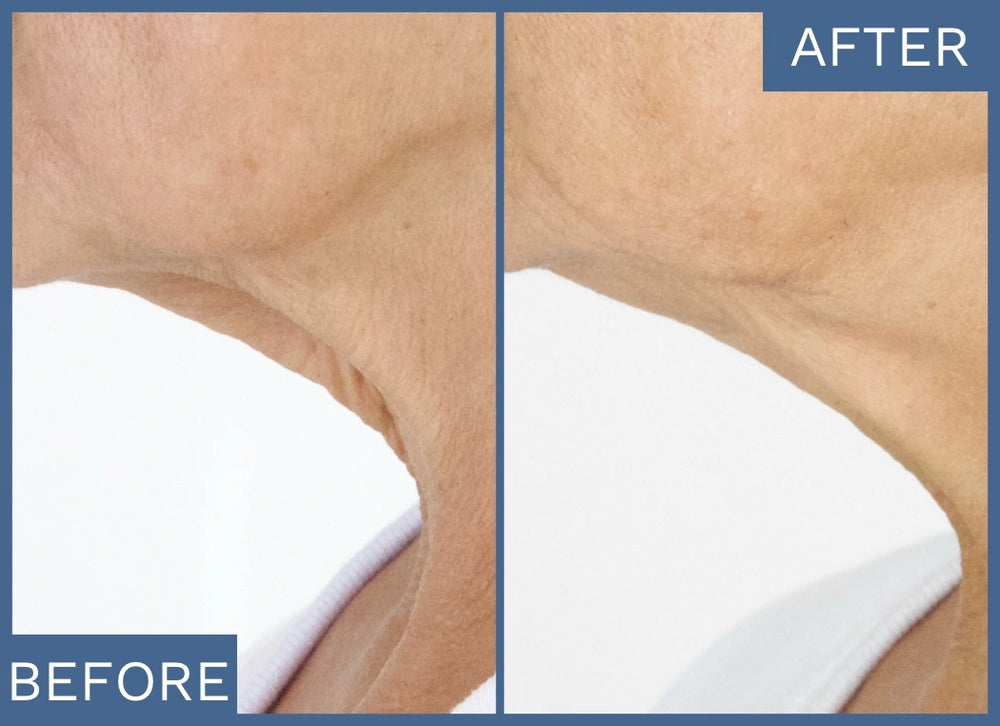 Tighter, Firmer Skin From Day One