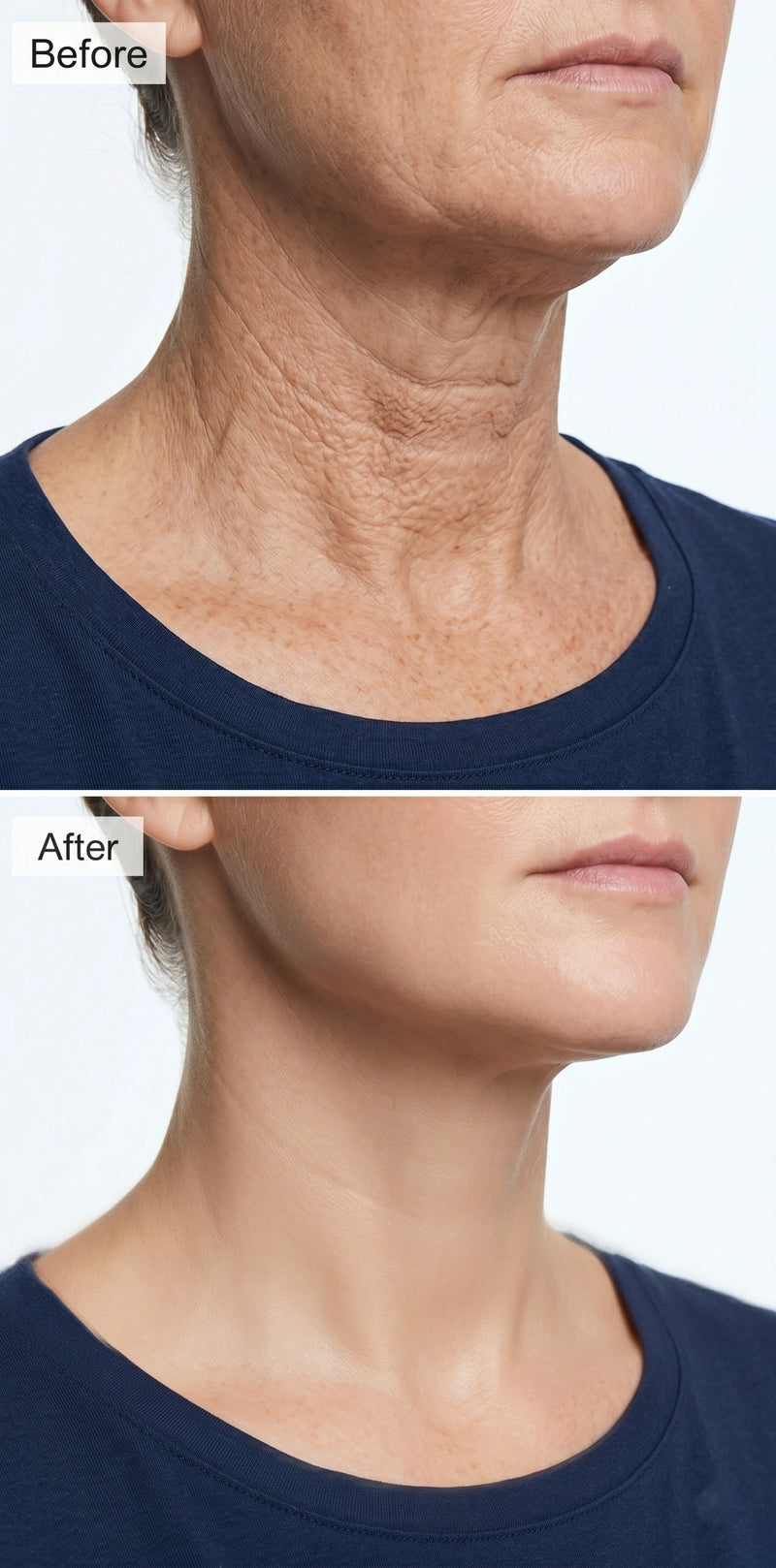 Before and after result
