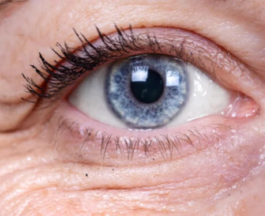3. It Minimizes the Appearance of Eye Wrinkles