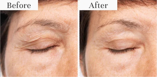 5. It Creates a Smoothing Effect and Firmer-Looking Skin