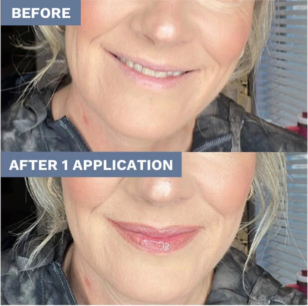 The Wait Is Over. Finally, a Solution for Thinning, Aging Lips! Women Over 50, Listen Up.