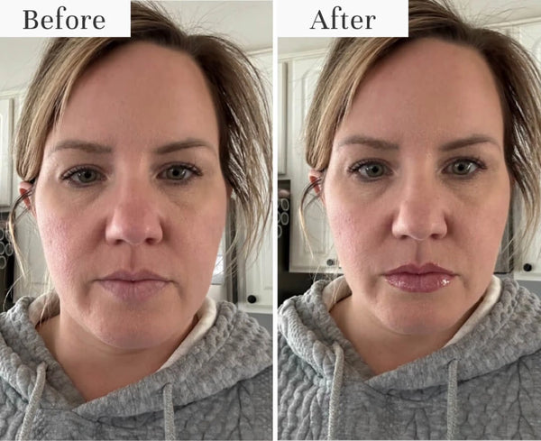 3. It Reduces the Appearance of Thinning Lips