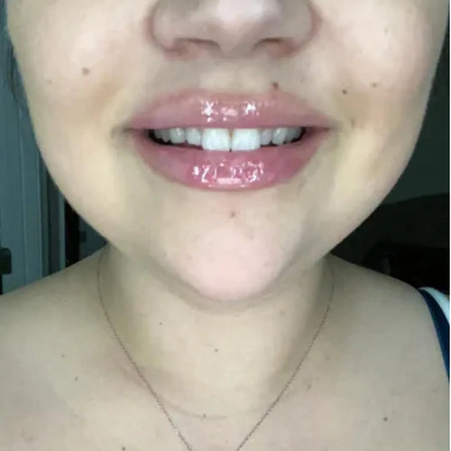 Real Customer Results: