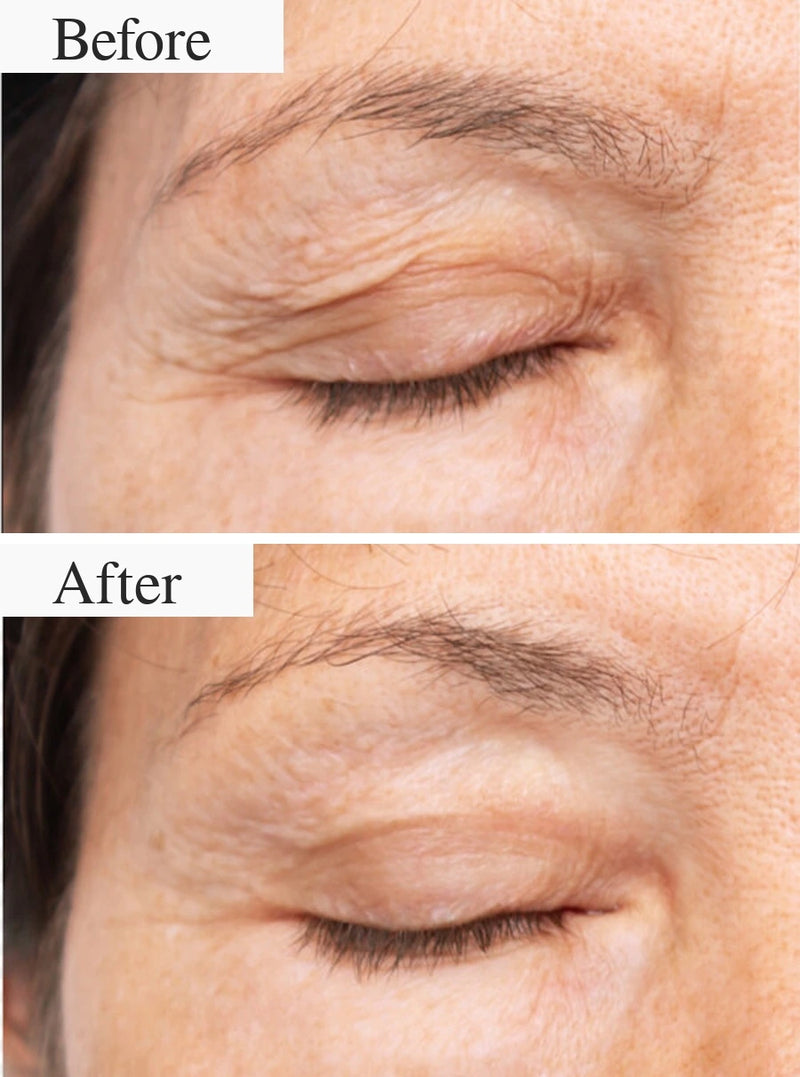 Before and after result